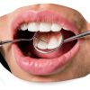 Stainless Steel Dental Mirror 6.5" Impressive Smile Anti‑Fog 45° Angle-1