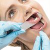 Dental Occlusal Photographic Mouth Mirror Set - Ceonam Rhodium (5 pcs)-4