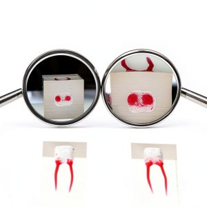 Magnifying Dental Mirror 3X Magnification Metal Handle Osung-0