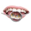 Dental Inspection Mirror Annhua Stainless Steel Anti-Fog Curved Mirror-3
