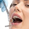 Light Dental Mirror with LED Steel – Healifty Model 15838D1TSG-8